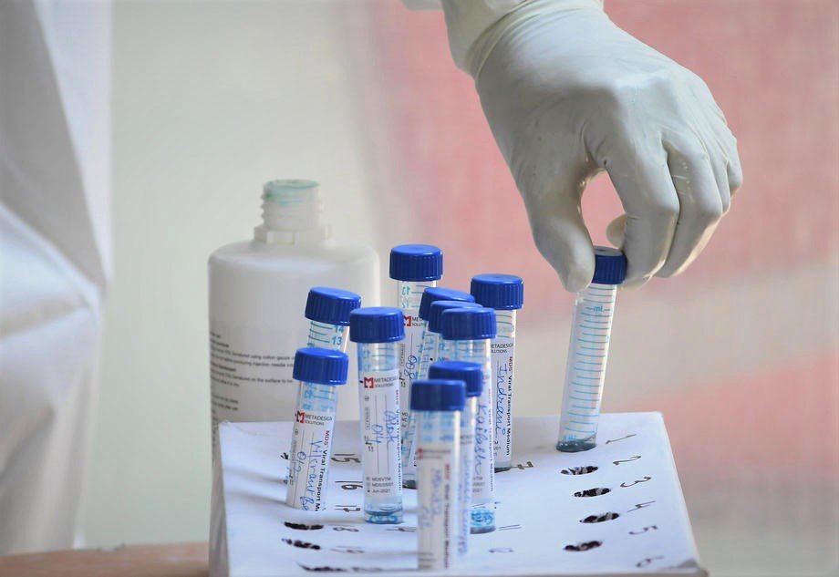 PSR test na lični zahtev u Kragujevcu čeka se dva do tri dana