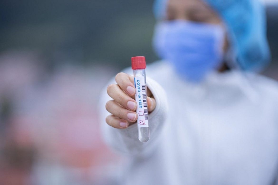 Novo uputstvo Batuta za PCR testove