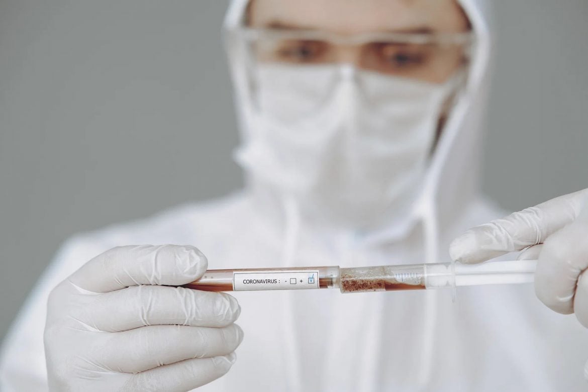 Od januara PCR testiranje na lični zahtev 9.000 dinara