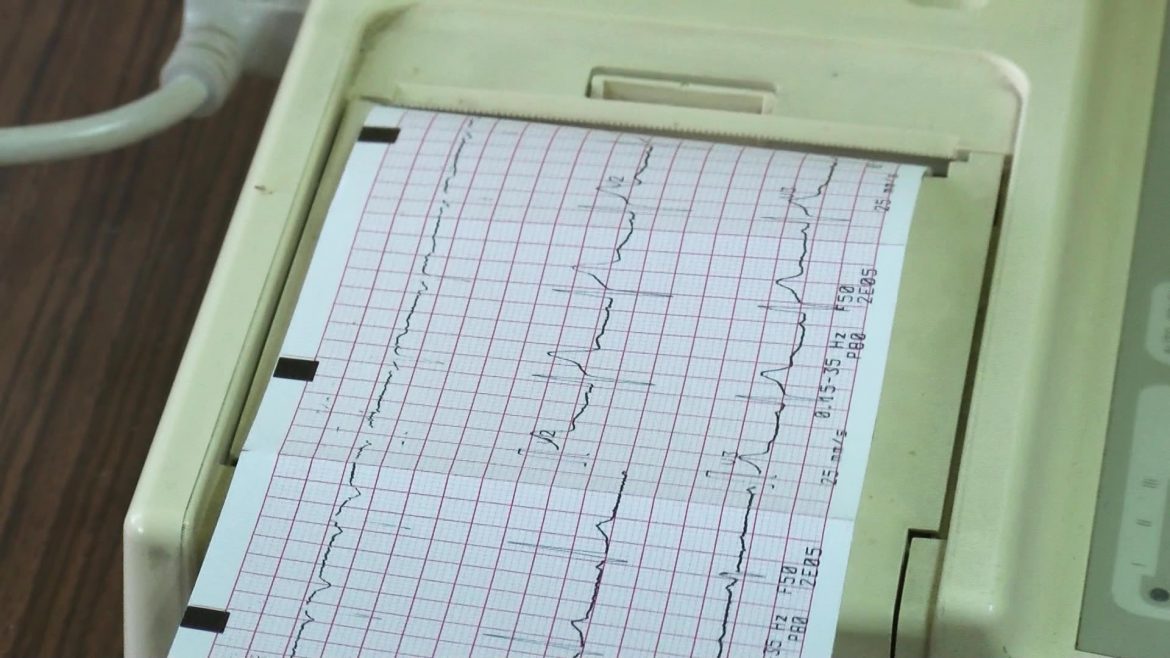 Nova studija sugeriše da EKG-AI može ranije otkriti rizike od kardiovaskularnih bolesti