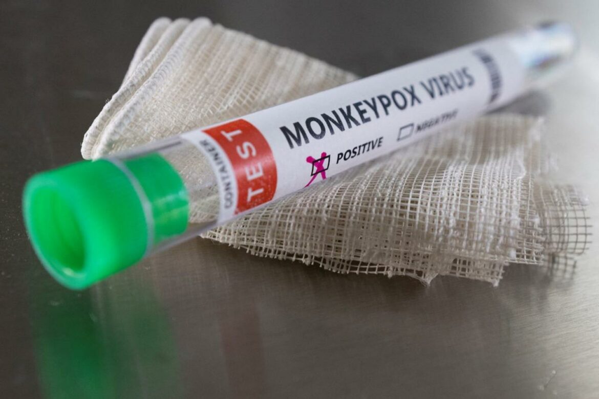 SZO: Skoro 200 novih infekcija majmunskim boginjama u više od 20 zemalja