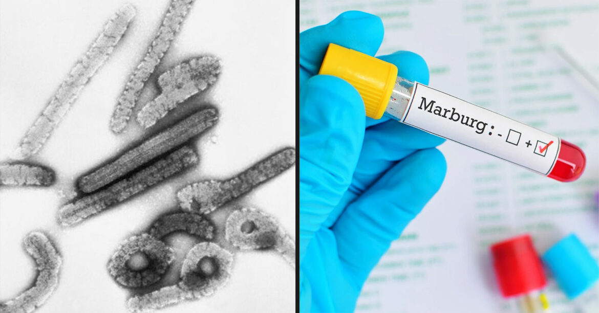 Dva pozitivna testa u Gani na visoko zarazni virus Marburg