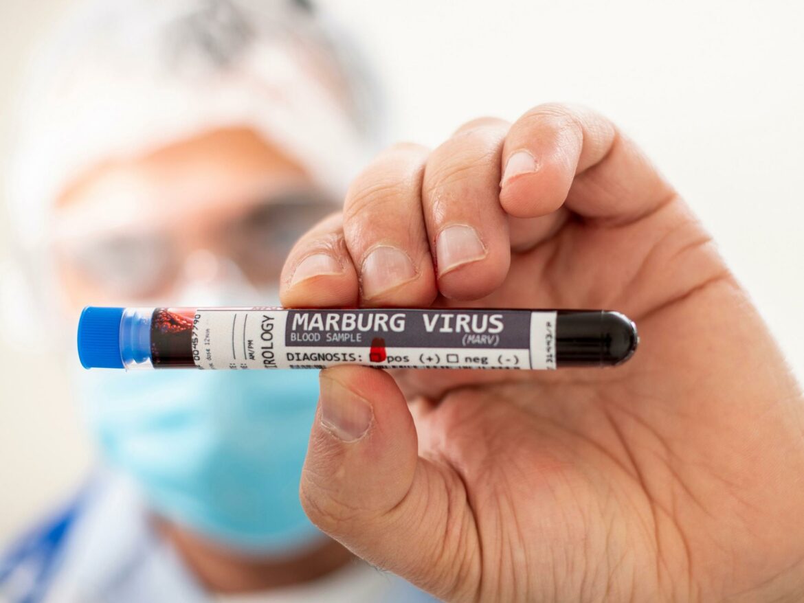 SZO: Potvrđena još dva slučaja virusa Marburga u Gani
