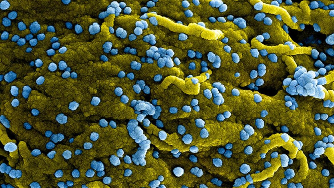 SZO proglasila novu epidemiju virusa