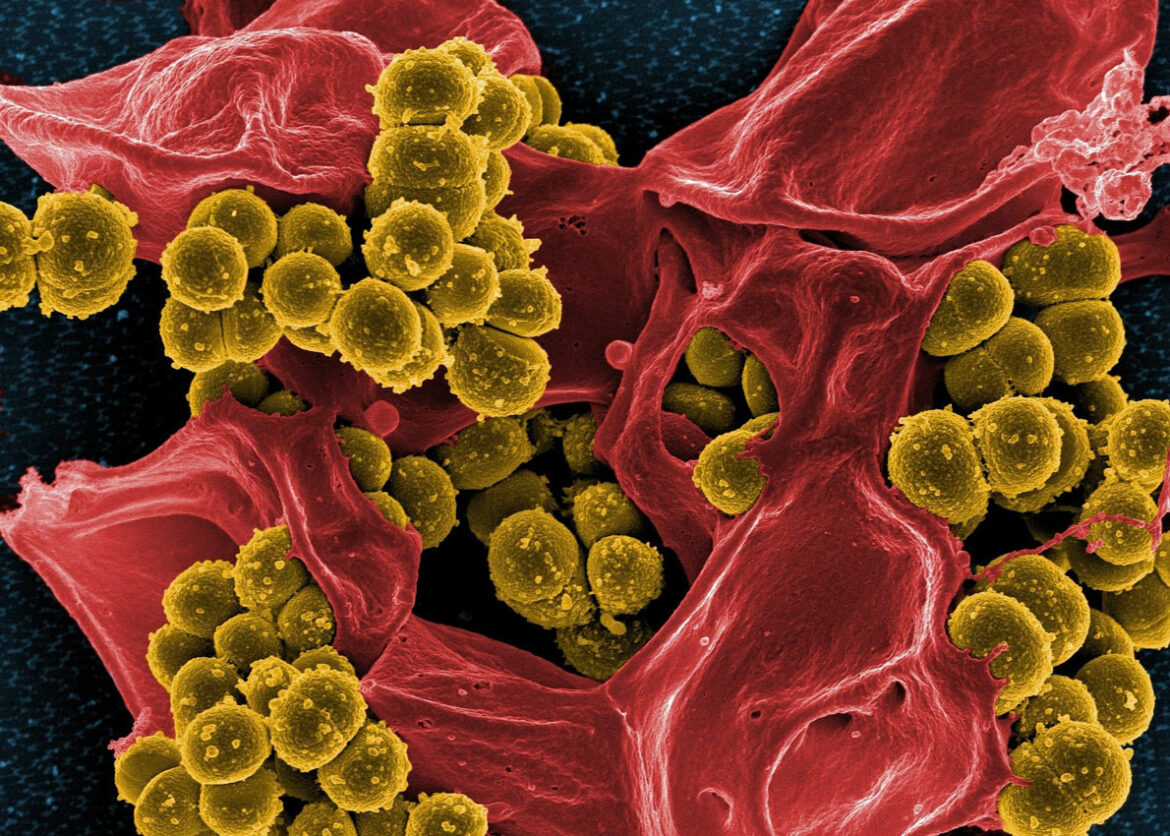 Kako prirodno jedinjenje ubija glavne bakterije otporne na lekove?