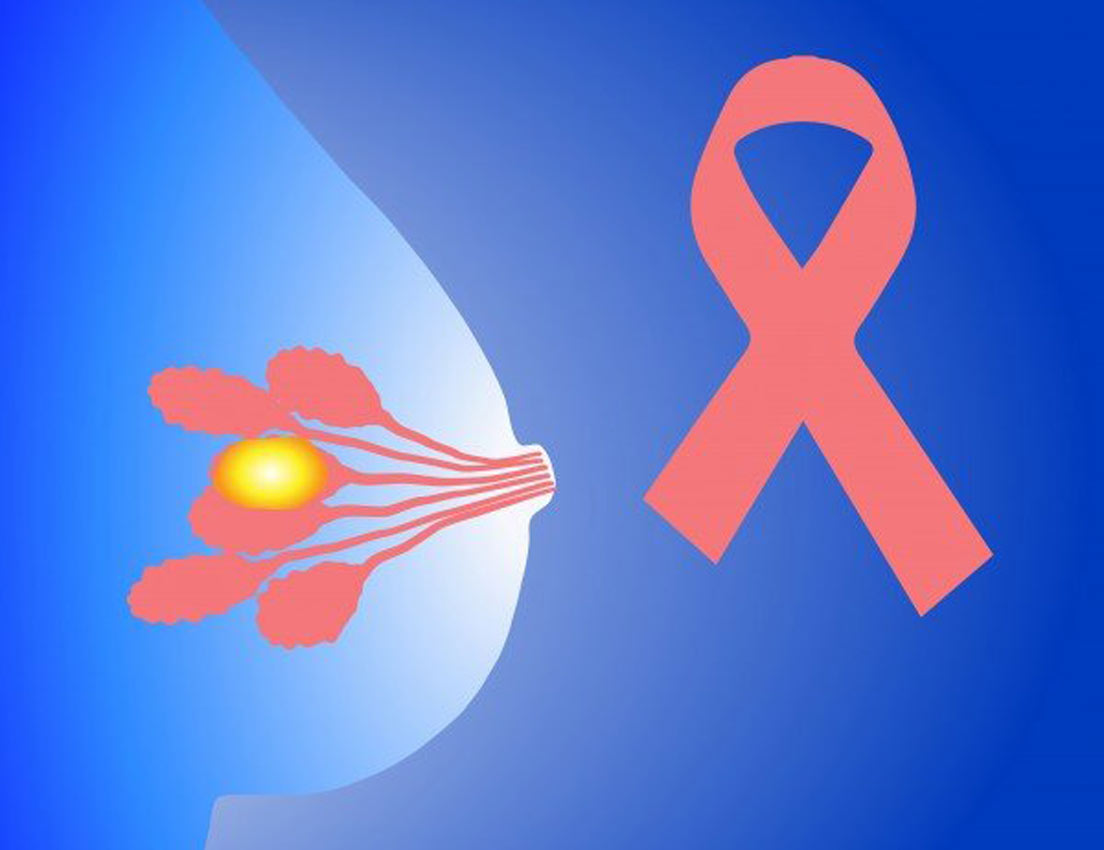 Istraživači identifikuju regulator razvoja raka dojke