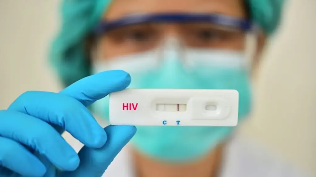 Nedostatak preporuka za testiranje u nacionalnim smernicama o HIV indikatorima