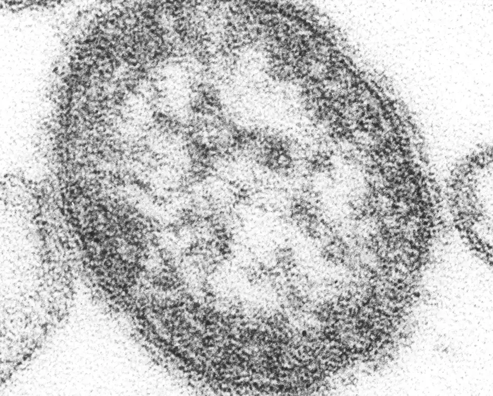 Virus morbila „koordinira“ sam sa sobom da izazove fatalni encefalitis