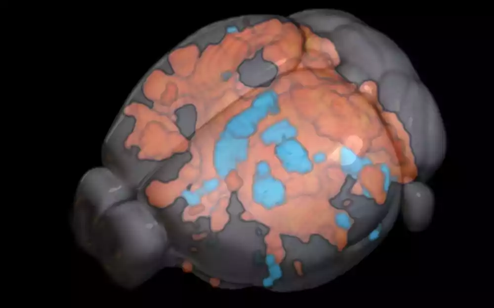 Nova ultrabrza fMRI tehnika može pomoći u informisanju stimulacije mozga