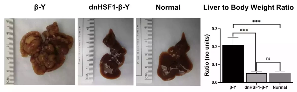 Novo istraživanje identifikuje potencijalnu metu lečenja hepatoblastoma, najčešćeg raka jetre kod dece