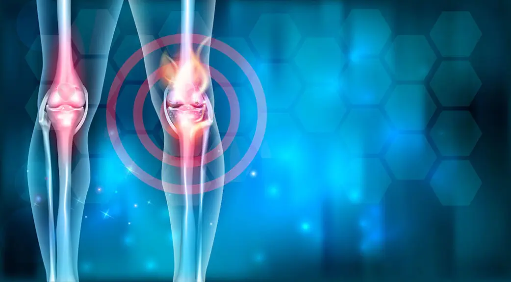 Novi test krvi tačniji u identifikaciji progresije osteoartritisa