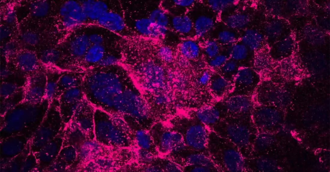 Inhibitori fibroblasta pomažu lekovima protiv raka u suzbijanju rasta raka