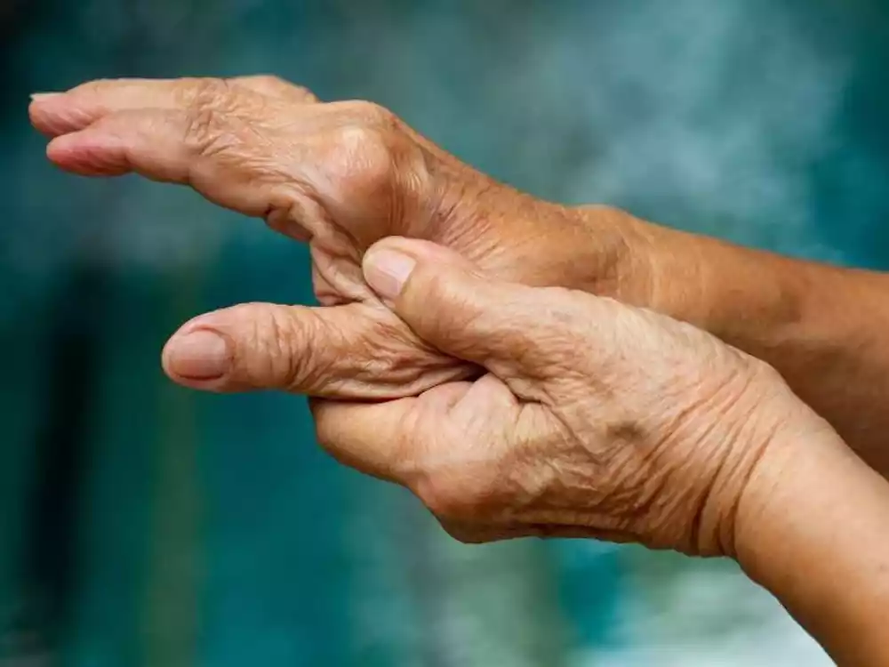 Uzročni put između bolesti desni i reumatoidnog artritisa