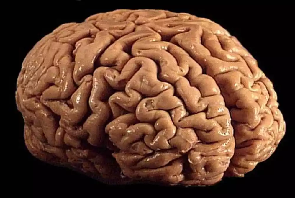 Uzrok prekomernog savijanja vijuga u moždanom korteksu