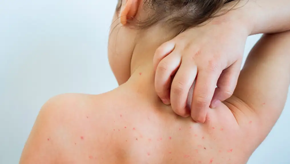 Dermatolozi testiraju obećavajući tretman za kožne bolesti
