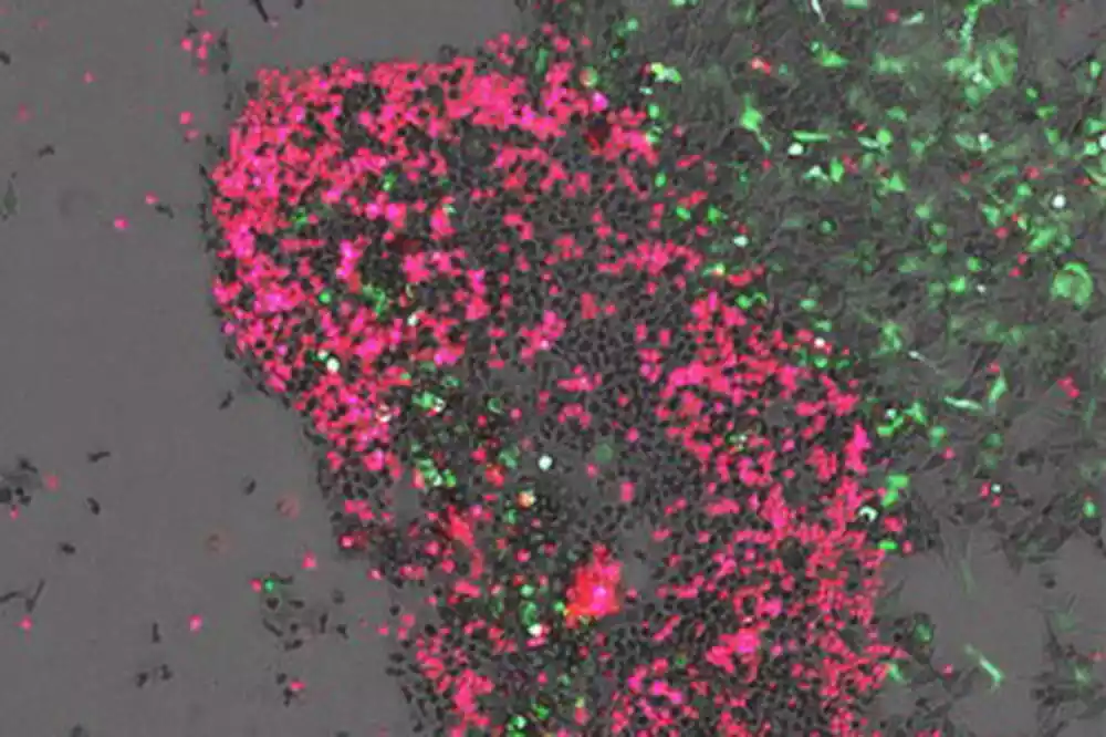 Modifikacije RNK koje ciljaju lek obećavaju za lečenje neuroblastoma