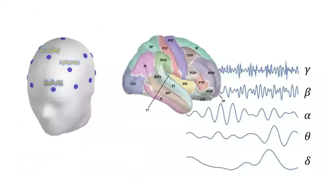 Nova EEG procedura precizno meri tegobe izazvane tinitusom