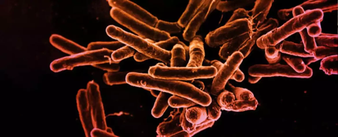 Aškenazi: Retka genetska bolest koja štiti od tuberkuloze