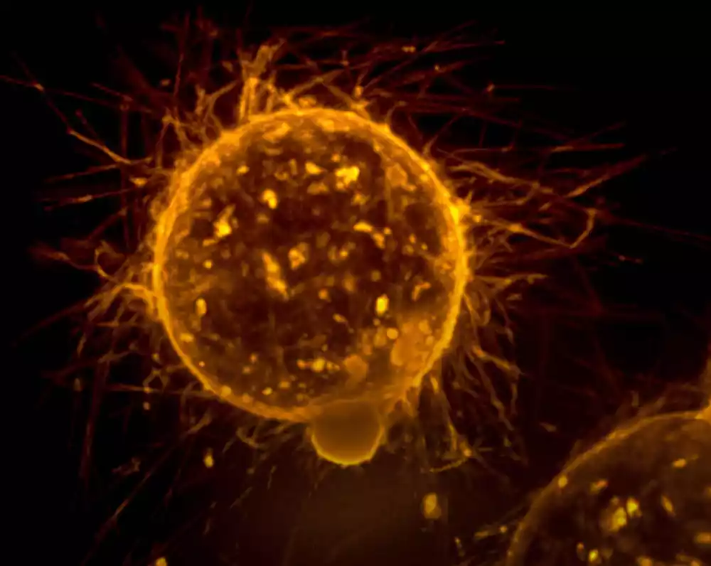 Studija otkriva molekularne puteve praćene metastatskim ćelijama raka