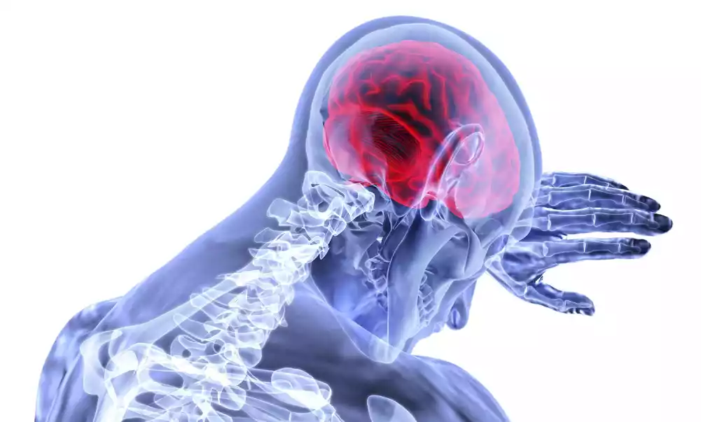 Trombektomija veoma efikasan tretman za velike moždane udare