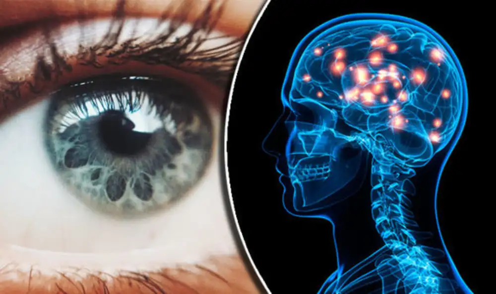 Novi uvidi u oštećenje oka kod pacijenata sa Alchajmerovom bolešću