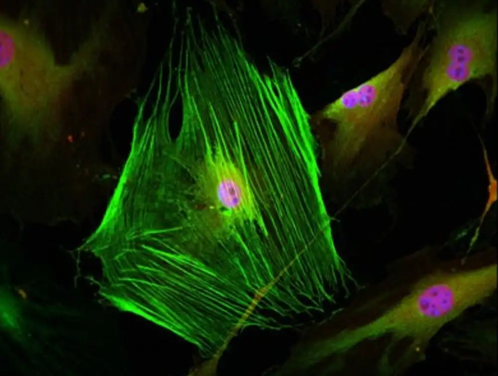 Identifikovan protein koji doprinosi fibrozi u više organa