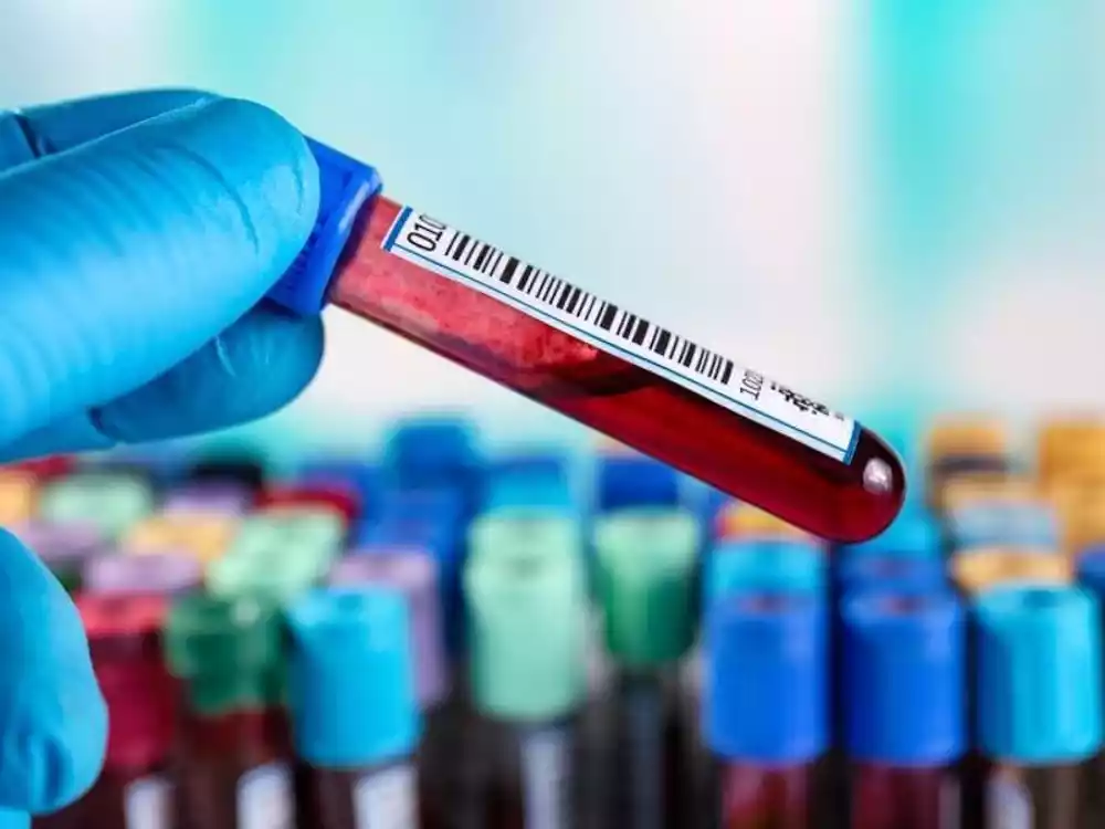 Genska terapija korisna za pacijente sa hemofilijom B
