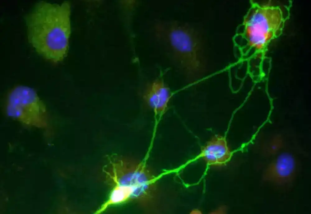 Ljudske matične ćelije oponašaju rani centralni nervni sistem