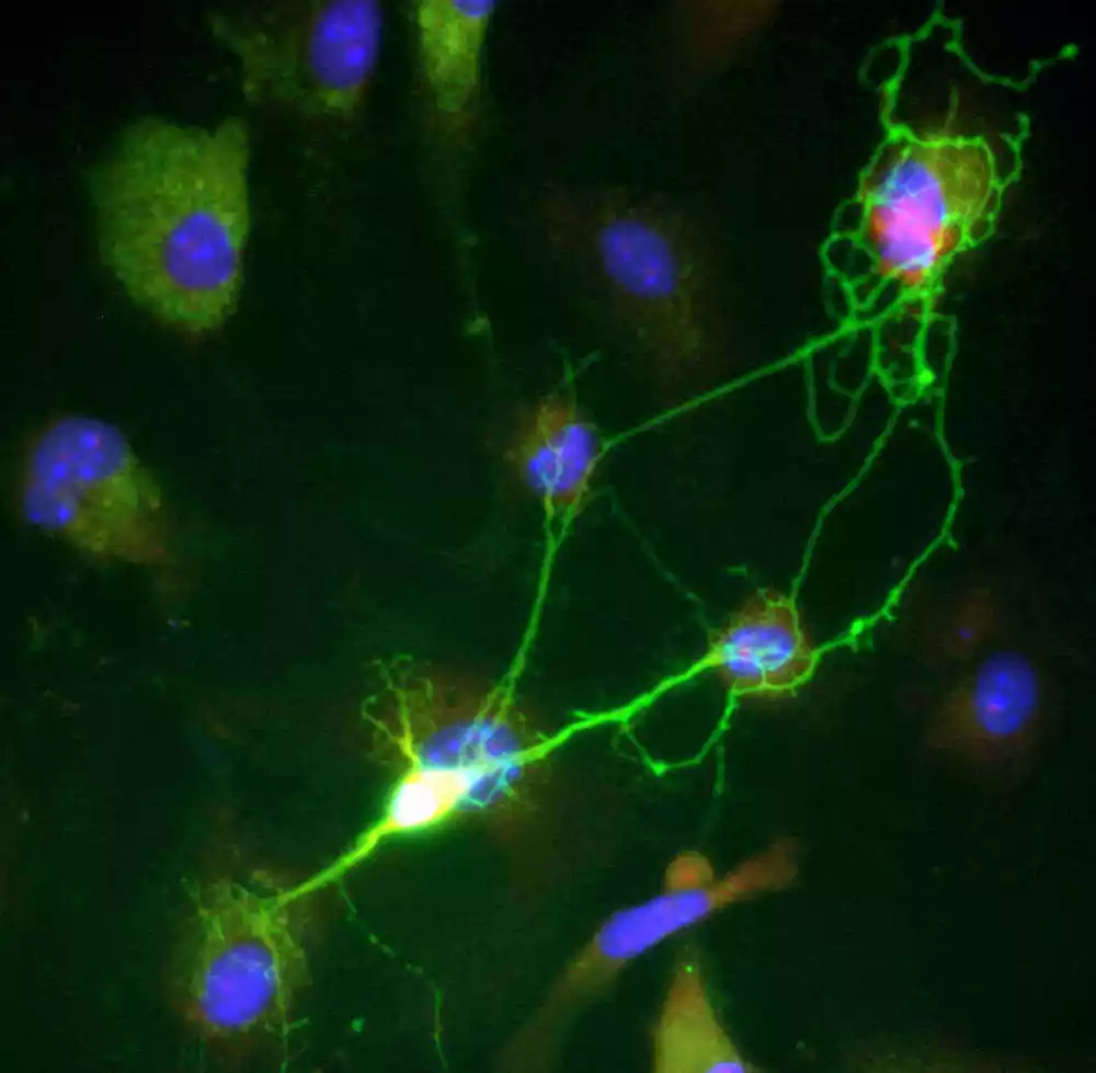 Naučnici otkrivaju kako da spreče smrt nervnih ćelija kod najčešćih oblika MND i demencije