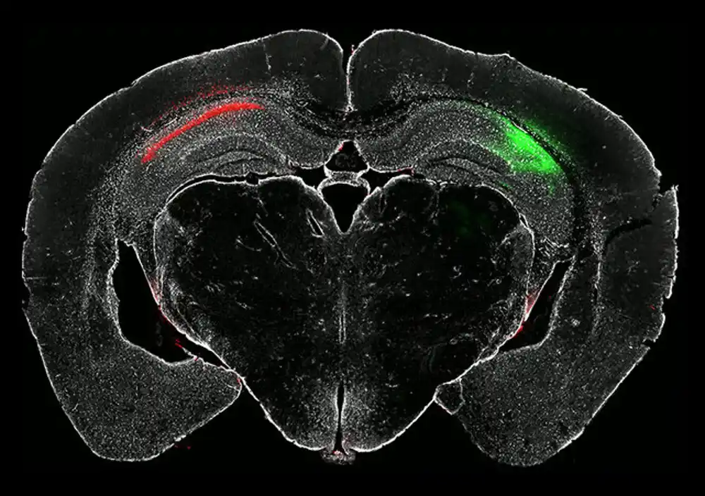 Nova vizuelna tehnika mogla bi unaprediti rano otkrivanje neurodegenerativnih bolesti