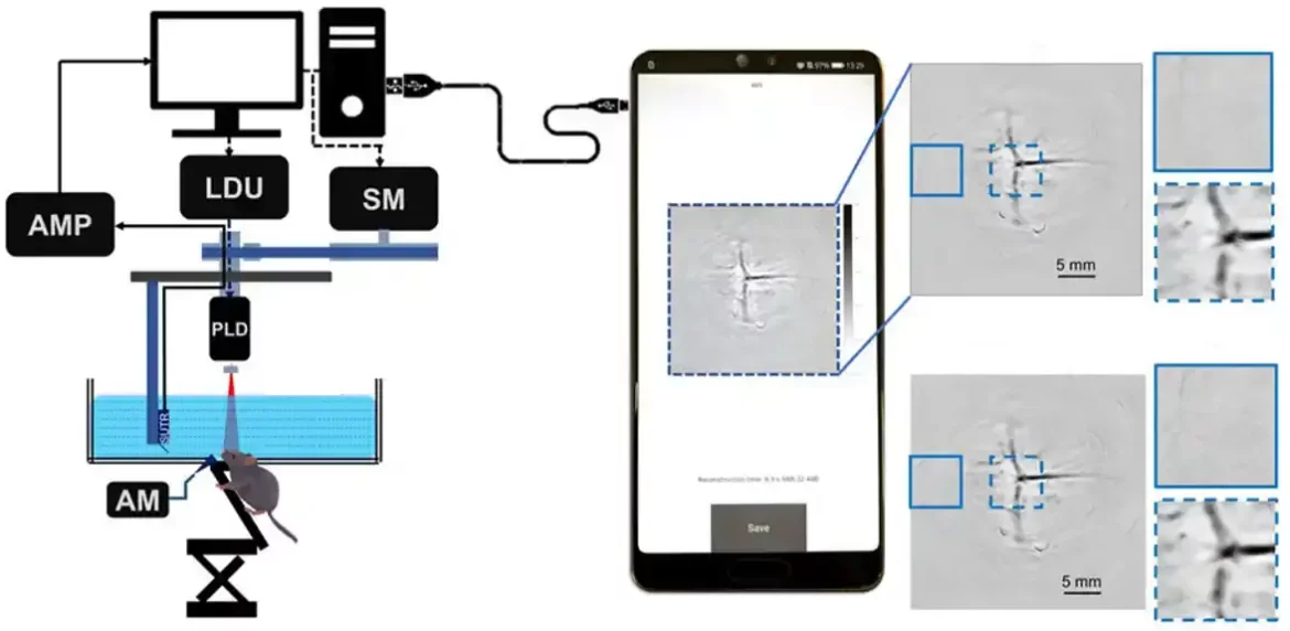 Aplikacija zasnovana na Androidu za fotoakustičnu tomografsku rekonstrukciju slike