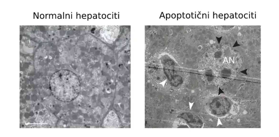 Bela krvna zrnca igraju neočekivanu ulogu u čišćenju mrtvih ćelija jetre