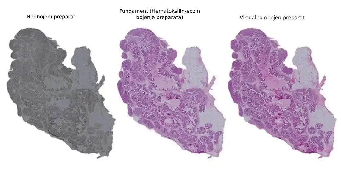 Istraživači razvijaju metod zasnovan na veštačkoj inteligenciji za zamenu hemijskog bojenja tkiva
