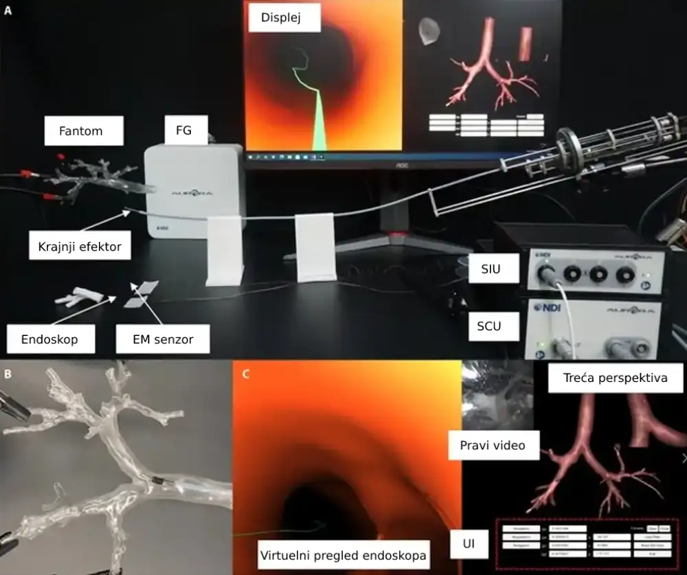 Novi robotski bronhoskopski sistem za navigaciju i biopsiju plućnih lezija