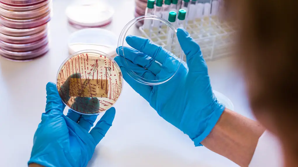 Zaustavljanje otpornosti na antibiotike: Istraživači su rasvetlili složenost tretmana bolničkih otpadnih voda