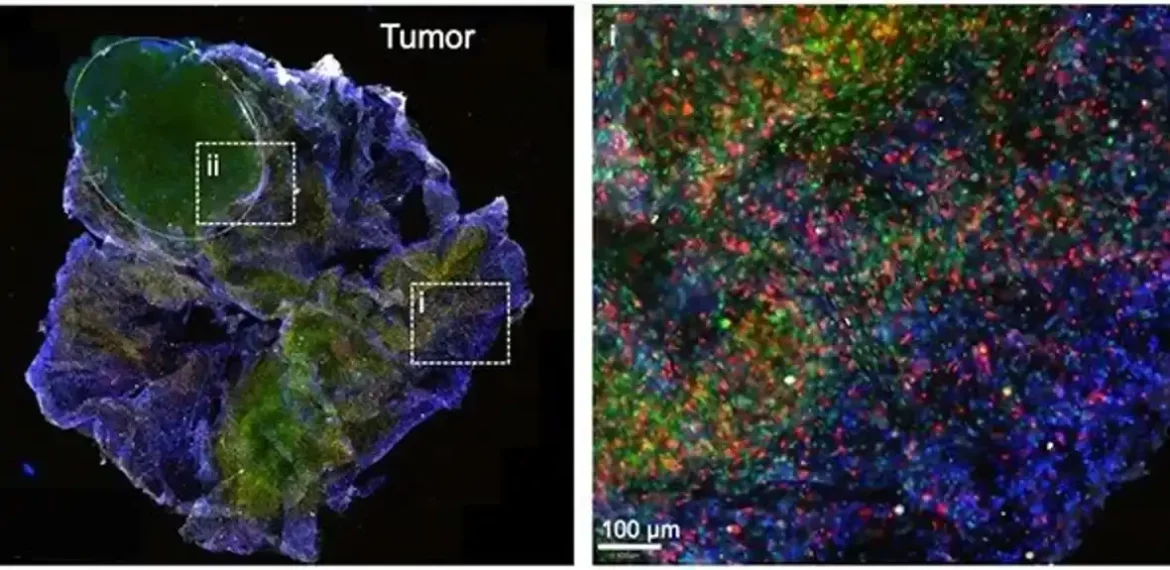 Prenosivi 3D bioprinter se pridružuje borbi protiv raka