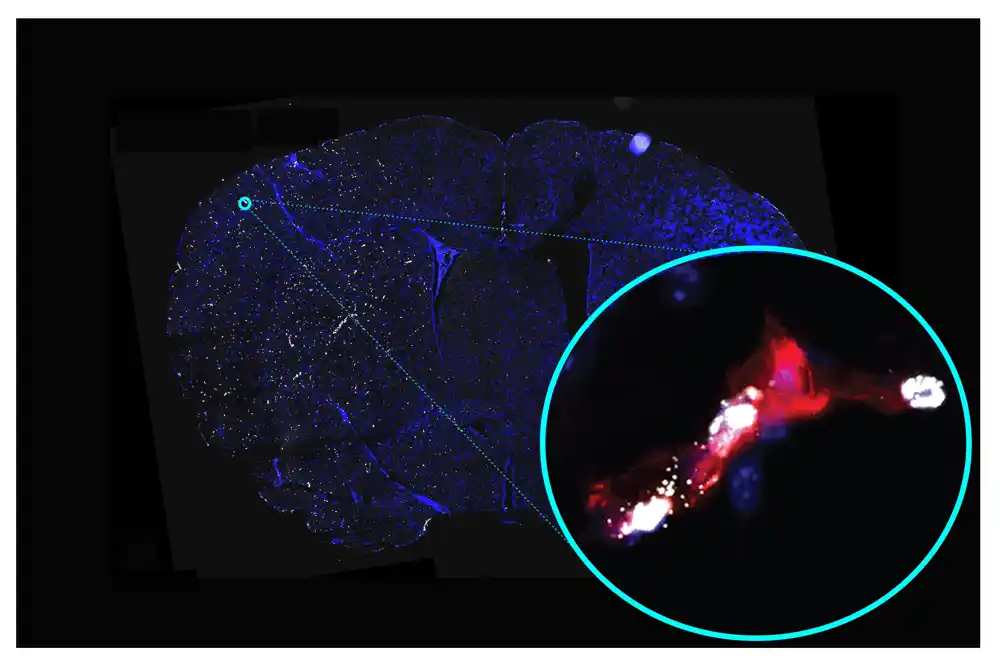 Proučavanje cerebralnih krvnih sudova otkriva potencijalne nove mete lekova za lečenje moždanog udara