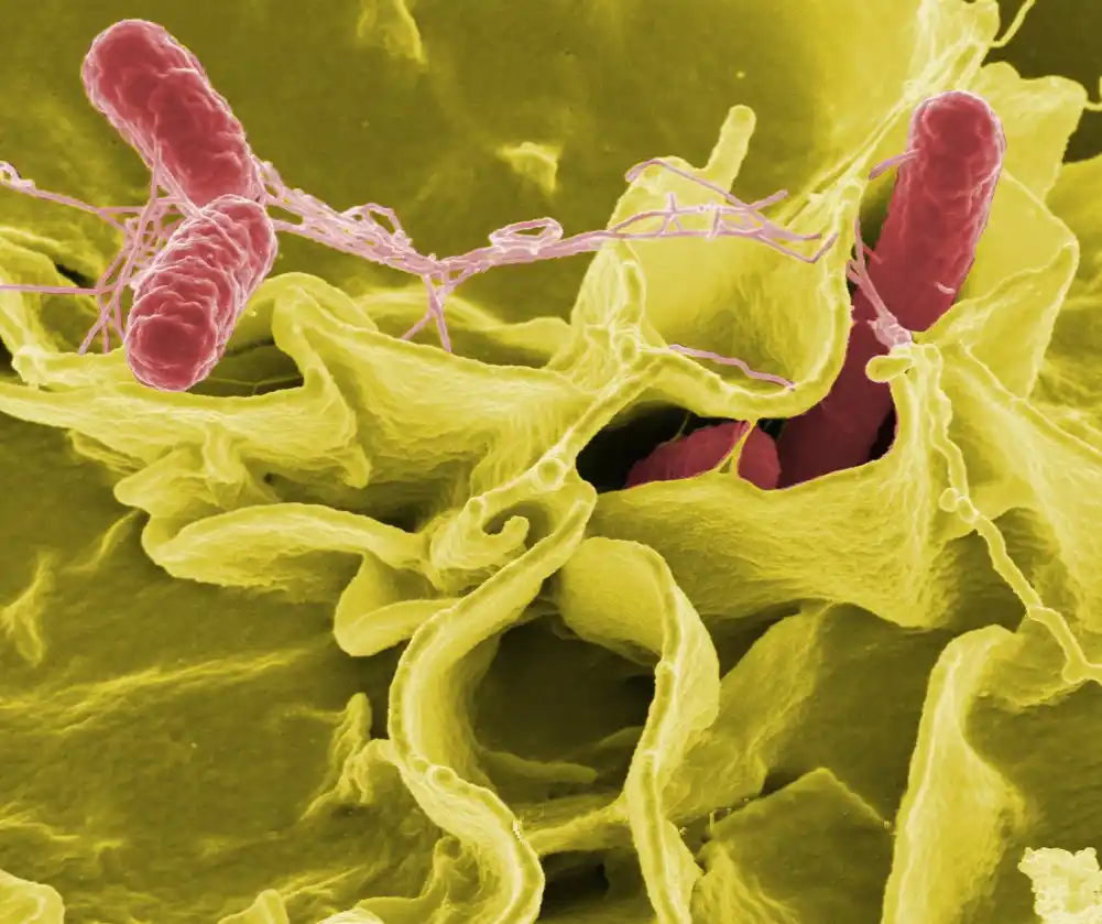 Intestinalne infekcije mogu promeniti sastav žuči, što dovodi do promena u funkciji imuniteta