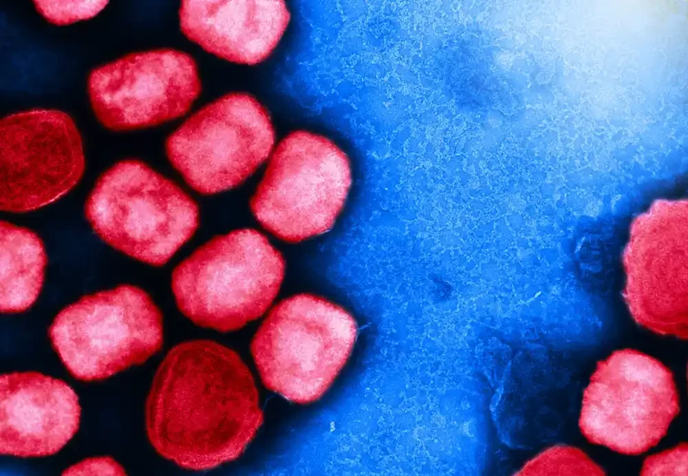 CDC podstiče vakcinaciju protiv mpok vakcine kako bi se sprečila letnja epidemija