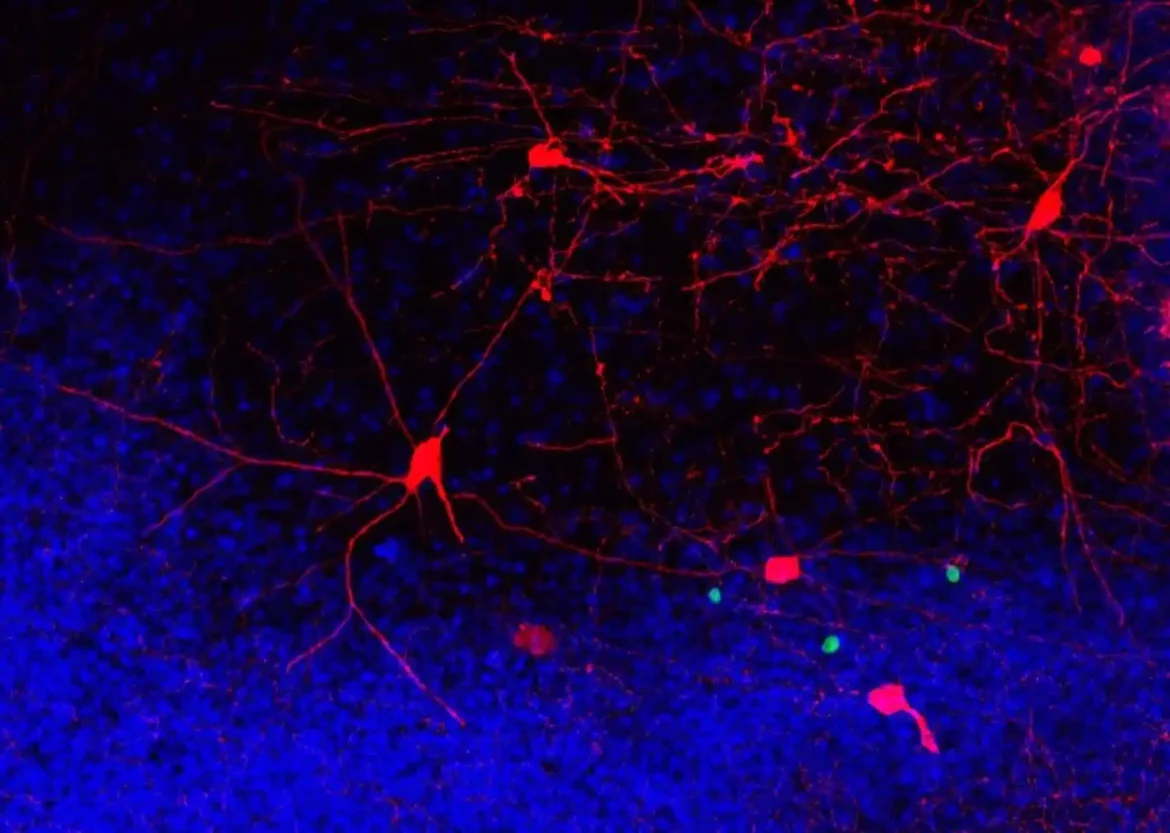 Trčanje tokom srednjeg doba održava ‘stare’ neurone ‘ožičenim’