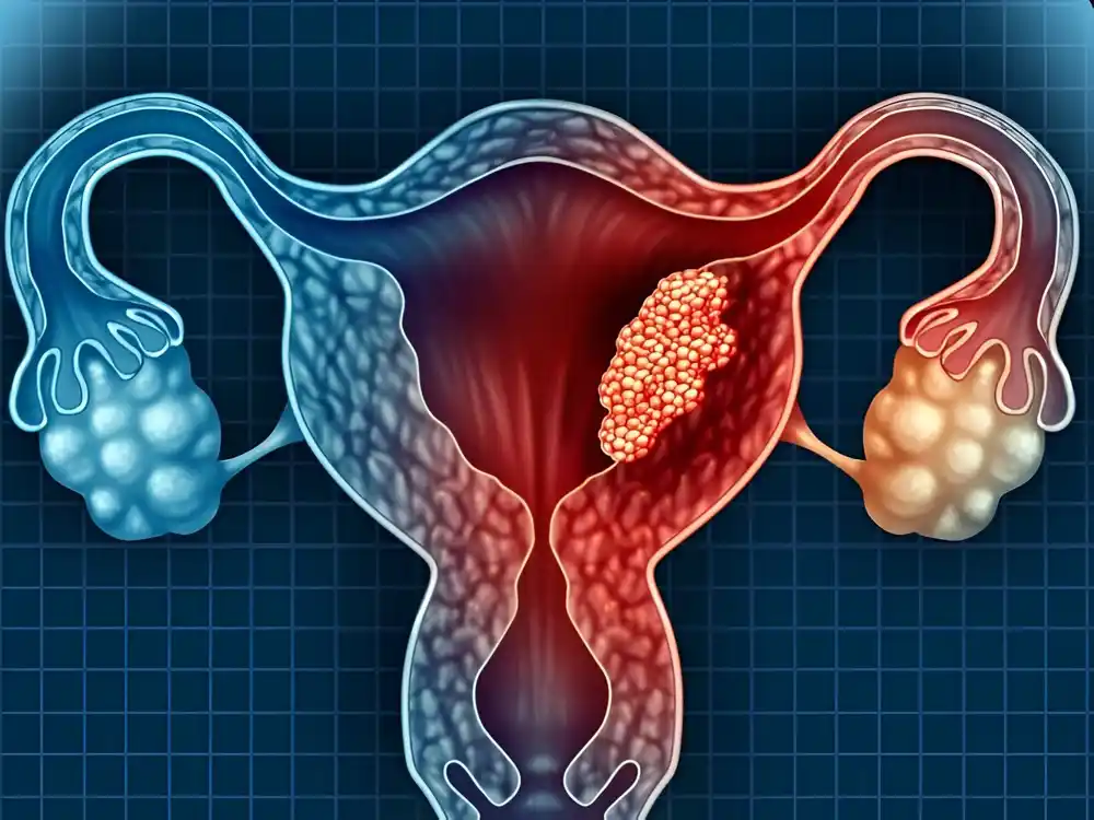 Mapa ljudskog endometrijuma otkriva skrivene zdravstvene tragove