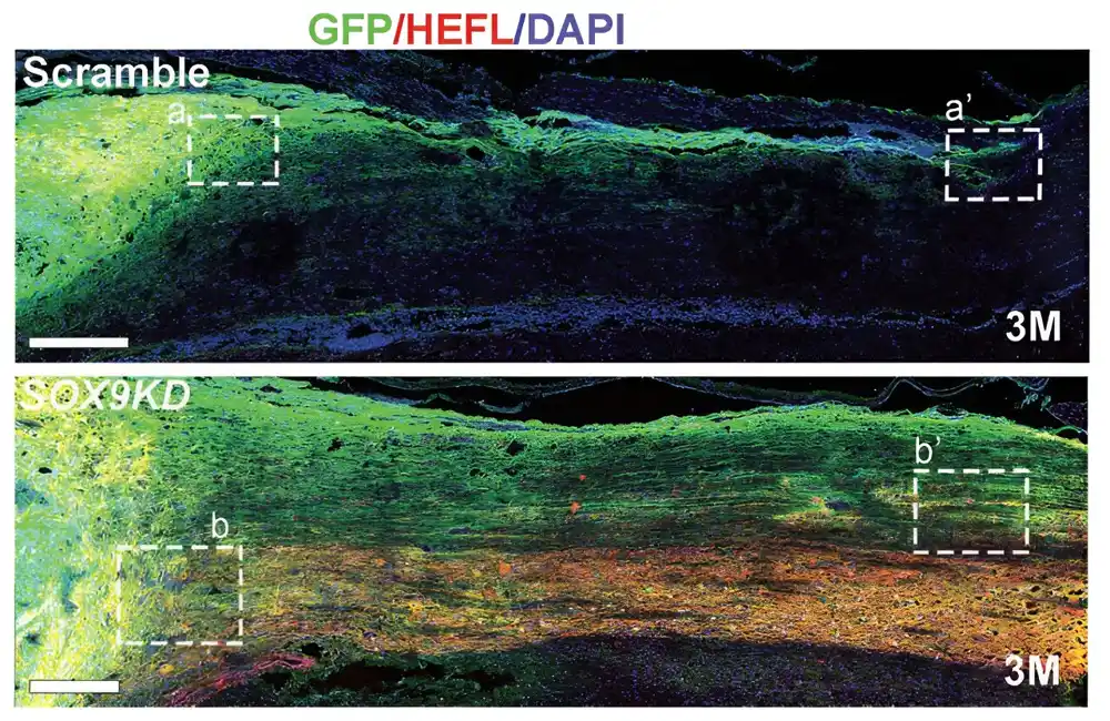 Genetski modifikovane neuralne matične ćelije pokazuju obećavajući terapeutski potencijal za povrede kičmene moždine