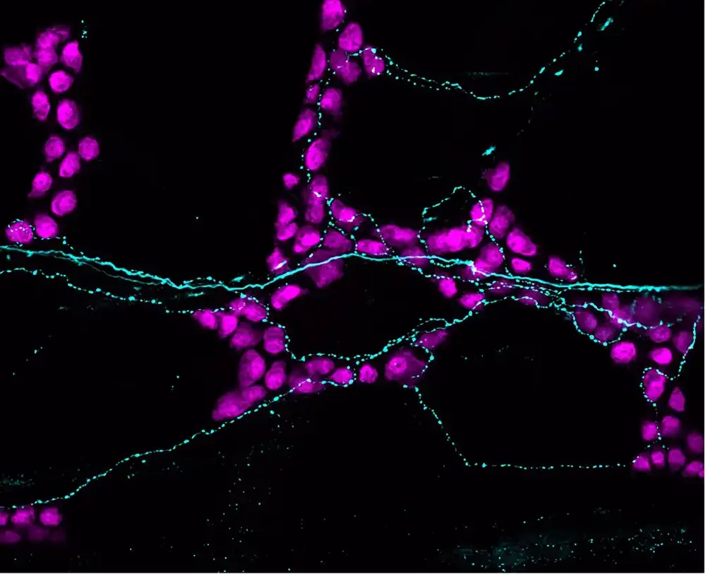 Kako senzorni neuroni utiču na creva