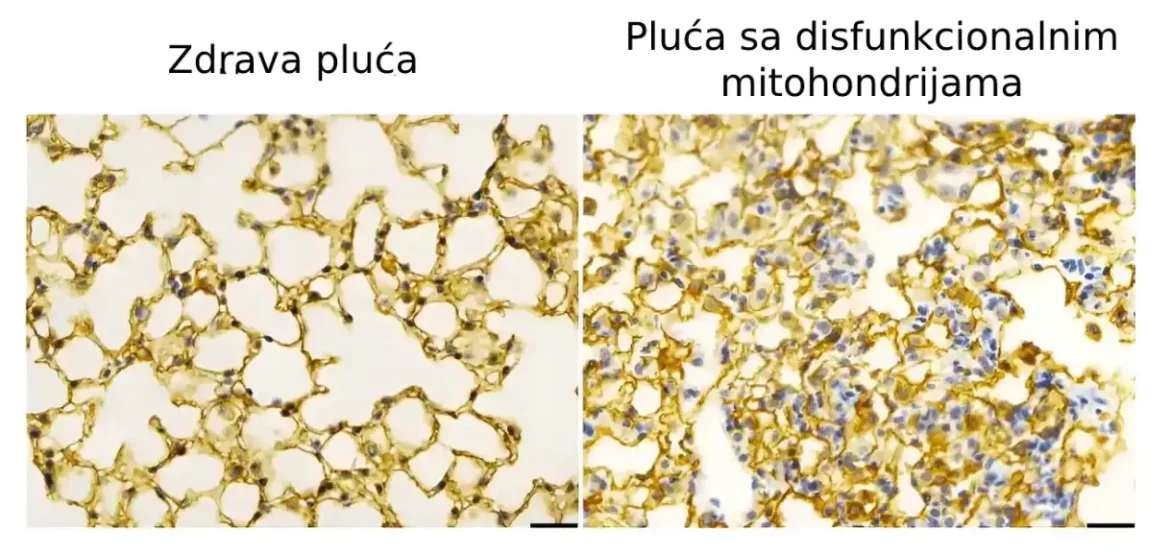 Mitohondrije regulišu ćelijsku signalizaciju za pravilan razvoj pluća