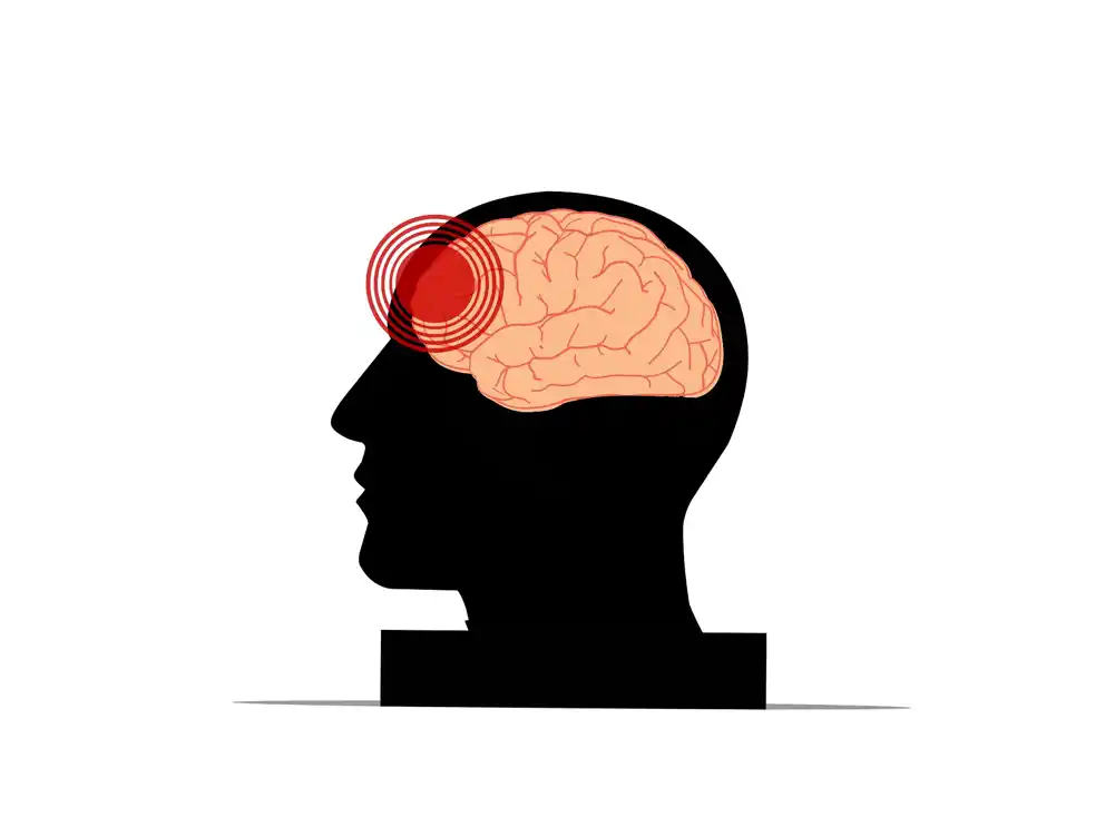 Istraživači identifikuju potencijalni novi podtip hronične traumatske encefalopatije