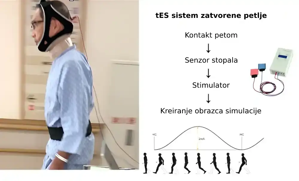 Stimulacija mozga poboljšava hodanje kod pacijenata sa Parkinsonovom bolešću