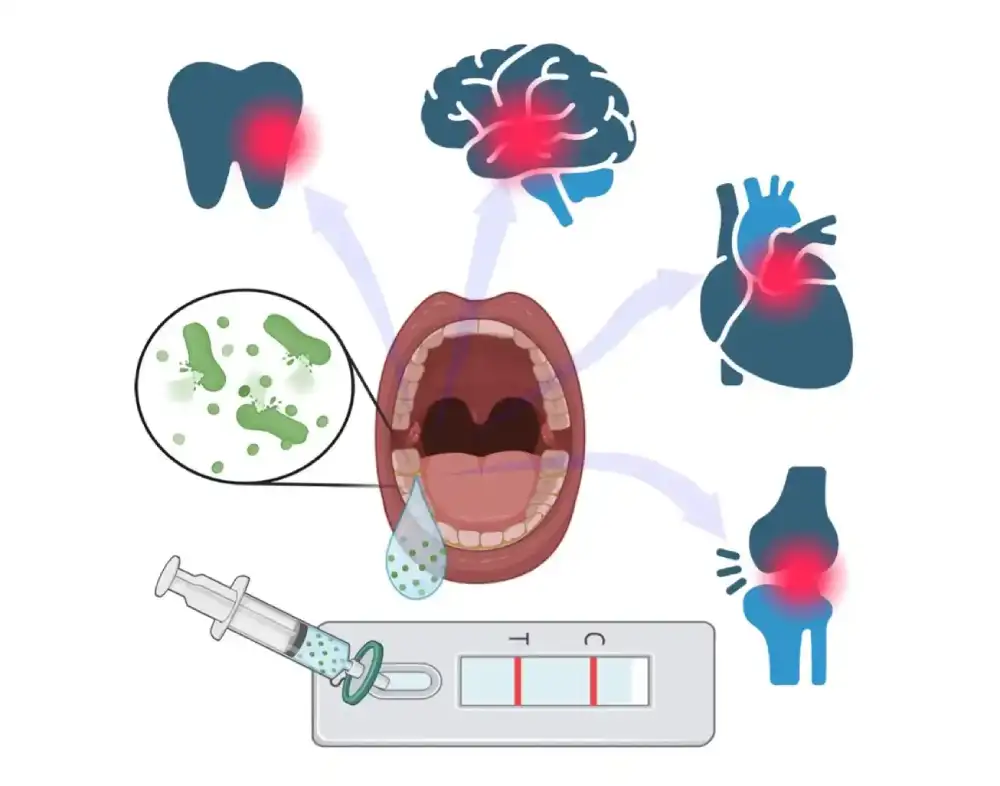 Inženjeri kreiraju test kod kuće koji može da dijagnostikuje gingivitis