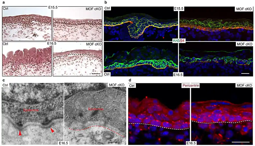 Studija otkriva značaj gena MOF u razvoju kože
