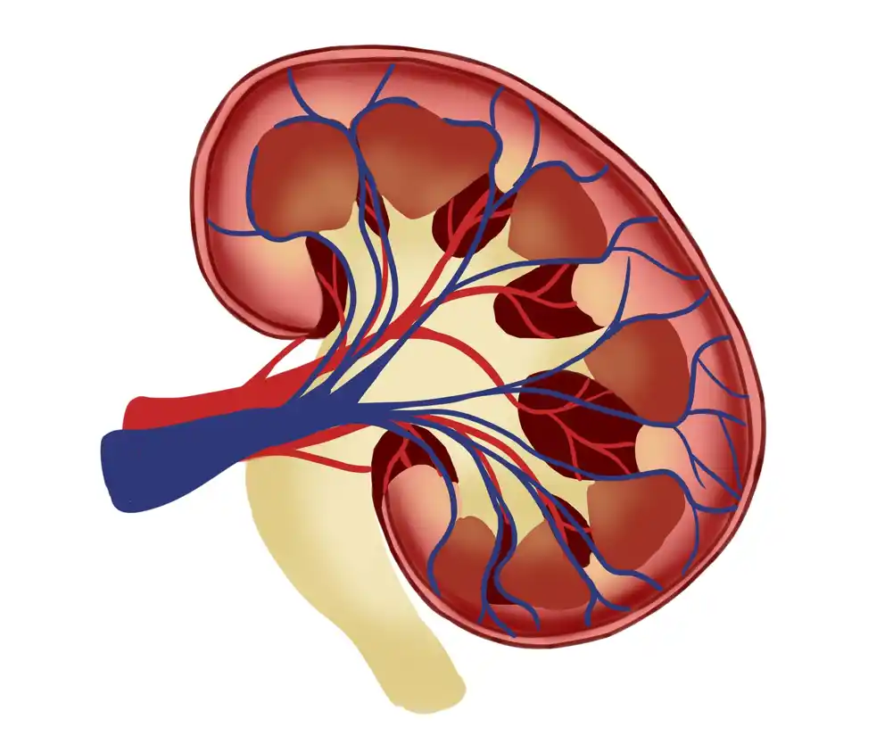 Abnormalni metabolizam laktata povezan sa povredom bubrega kod pacijenata sa dijabetesom