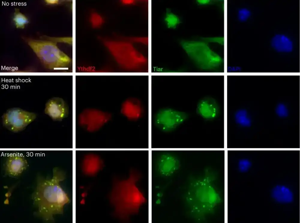 Naučnici su rasvetlili kako ćelije pod stresom sekvestriraju mRNA koje formiraju proteine
